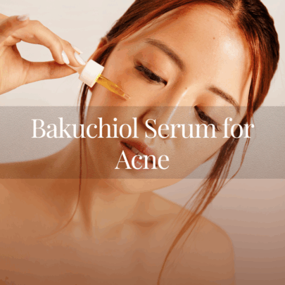 Bakuchiol Serum for Acne: Week-by-Week Results and What to Expect